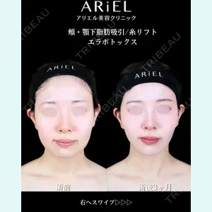 アリエル美容クリニック 大宮院 鈴木　桂介医師の症例