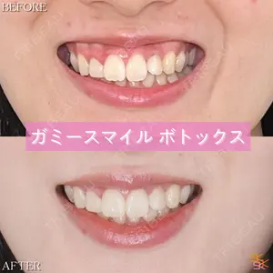 SK新宿歌舞伎町美容外科・歯科の症例