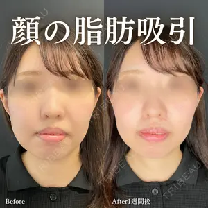 ルラ美容クリニック 渋谷本院 住友 沙織医師の症例