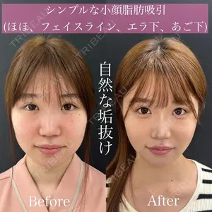 ルラ美容クリニック 渋谷本院 昼間 路子医師の症例