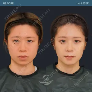 症例