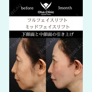 Otus Clinic 【オータスクリニック】 中 徳太郎医師の症例