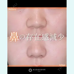 東京形成美容外科 船橋院 山田 大輔医師の症例