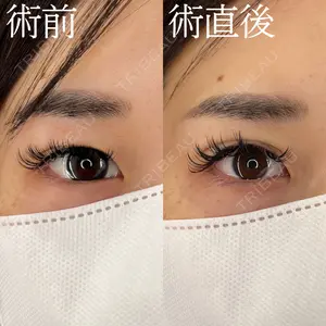 症例