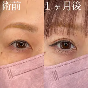 HAAB×DREAM BEAUTY CLINIC 大阪梅田院 柏木 太雅医師の症例