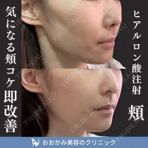 症例