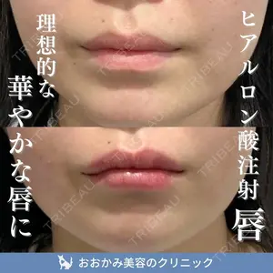 症例