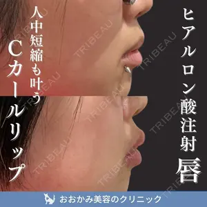 症例