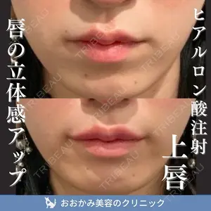 症例
