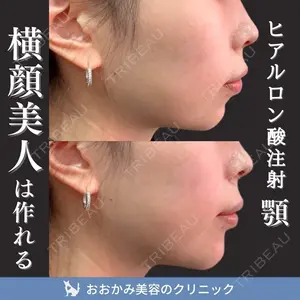症例