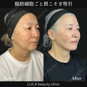 ルラ美容クリニック 新宿院 高木 欽之医師の症例