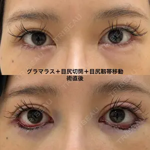 エターナル美容クリニックの症例