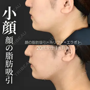 症例