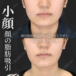 症例