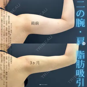 湘南美容クリニック 名古屋駅本院 友池 力医師の症例