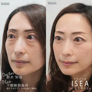症例