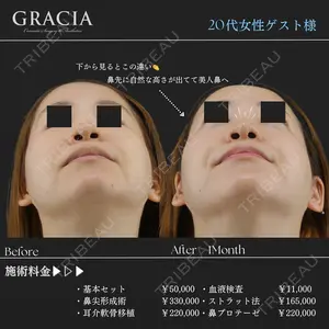 GRACIA clinic 【グラシアクリニック】 中井 孝昌医師の症例