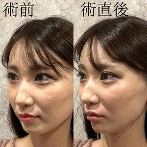 症例