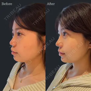 HAAB×DREAM BEAUTY CLINIC 東京本院 佐野 圭医師の症例