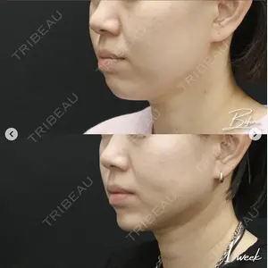 湘南美容クリニック 松戸院の症例