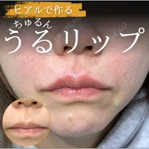 ルラ美容クリニック 高田馬場院 若佐 卓矢医師の症例