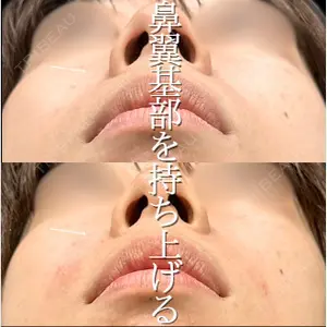 ルラ美容クリニック 高田馬場院 若佐 卓矢医師の症例