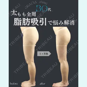 GRACIA clinic 【グラシアクリニック】 谷口　正和医師の症例