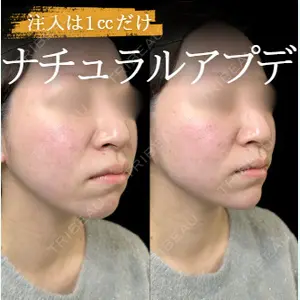 ルラ美容クリニック 高田馬場院 若佐 卓矢医師の症例