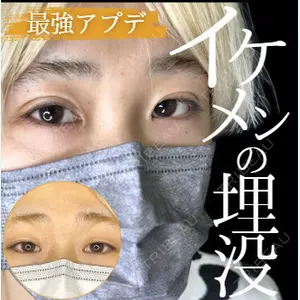 ルラ美容クリニック 高田馬場院 若佐 卓矢医師の症例