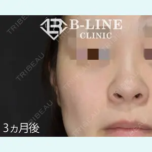 B-LINE CLINIC 池袋院 小池 康弘医師の症例