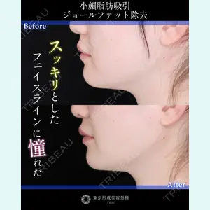 東京形成美容外科 船橋院 山崎 修吾医師の症例