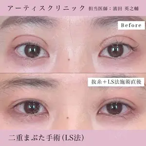 症例
