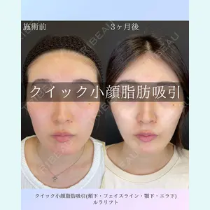 ルラ美容クリニック 札幌院 佐藤 雄紀医師の症例