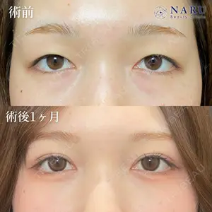 症例