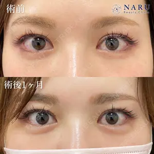 症例