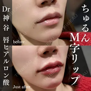 EMMO FACE CLINIC 大阪梅田院 神谷 一成医師の症例