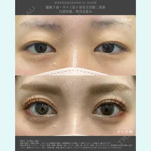 湘南美容クリニック 銀座院の症例