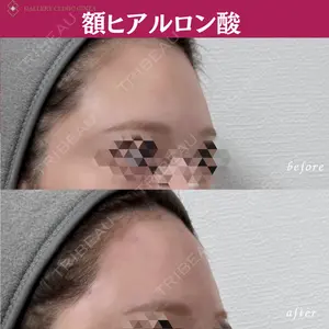ギャラリークリニック 銀座の症例