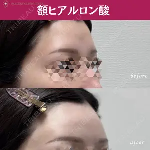 ギャラリークリニック 銀座の症例
