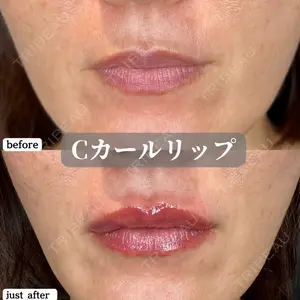 ルラ美容クリニック 神戸院の症例