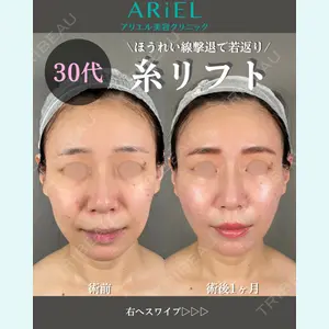 アリエル美容クリニック 大宮院 鈴木　桂介医師の症例