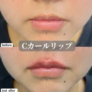 ルラ美容クリニック 神戸院の症例