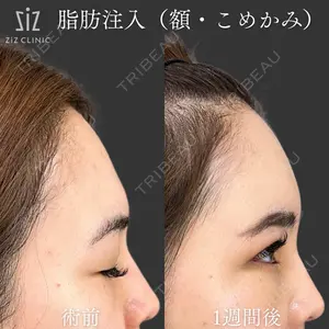 ziz CLINIC 村岡 史子医師の症例
