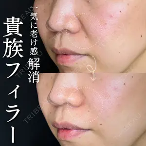 ルラ美容クリニック 大宮院 右京 大季医師の症例