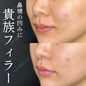 ルラ美容クリニック 大宮院 右京 大季医師の症例
