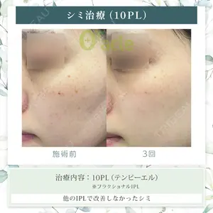 オラクル美容皮膚科 東京新宿院の症例