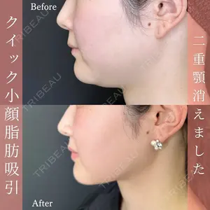 ルラ美容クリニック 名古屋本院の症例
