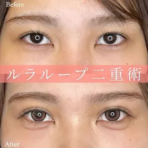 ルラ美容クリニック 名古屋本院 酒井 俊行医師の症例