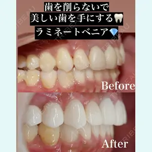 症例