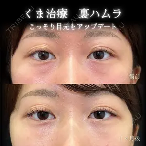 eクリニック 大阪院 脇谷 雄一朗医師の症例